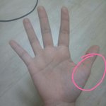 나처럼 <b>엄지</b>손가락 좀 이상한사람있음?