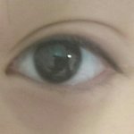 [ㅋㅋㅋㅋㅋ] 다래끼 때문에 <b>눈</b> <b>개</b>부음