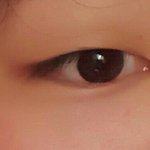 쌍수 ㅈㄴ고민된다 조언좀