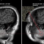 [개깊은빡침] 세상에 이런일이~ !!!!!!