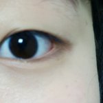 [조언부탁해] 얘들아 쌍수할까 말까 추반좀ㅠㅠ