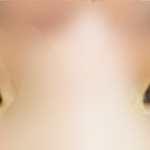 <b>쌍수</b>ㅠㅠ망한거같은데 경험자님ㅠㅠㅠ