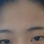 쌍수하면 망할눈임??