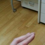 [약혐주의] 애들아 나 엄청난 상처 생겼는데