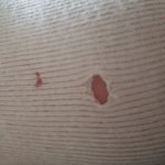 소주병 <b>조각</b>에 신발뚫렸어(혐