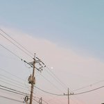 [개깊은빡침] <b>눈아래</b> 점 생겼는데 연예인병이녜