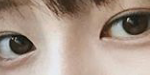 [드루와] <b>이눈</b> 성형으로 가능?