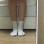 [조언부탁해] <b>종아리</b>알 더빼야할까??