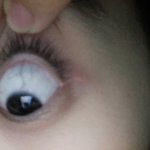 [댓글부탁해] (사진혐오주의)하루에 <b>써클</b>렌즈 10시간씩끼는데
