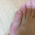 [조언부탁해] 미친 애들아 발가락이너무아파 도와줘