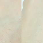 [댓글부탁해] <b>롭스</b> 여드름연고 비교해봤어! (4개제품)