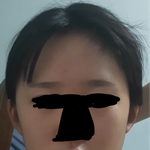 [댓글부탁해] 저 <b>양악</b>수술 해야 할까요??