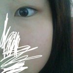 쌍수 할 건데 눈 괜찮아 ?