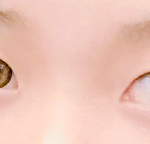 [댓글부탁해] 나 쌍수하면 어떨 것 같아..?