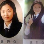 <b>홍진영</b> 성형전