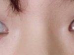 [댓글부탁해] 쌍커풀 수술 할까요?