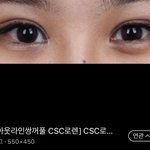 [꼭댓글부탁] 쌍수 의사<b>쌤</b>이 잡아주는 라인있자나 제발 드루와