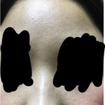[꼭조언부탁] (혐주의)이런 피부 어떻게 관리해야해요ㅠ?