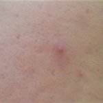 [뷰티] 세젤최 지성 여드름쟁이의 스킨케어 루틴 (스압 혐피부주의)