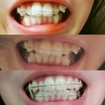 [드루와] (약혐)오 얘들아 교정 개신기함