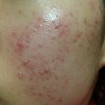 [조언부탁해] 기초화장품 바르기 <b>전후</b> 피부 너무다른데..