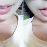 [댓글부탁해] 토끼<b>이빨</b> 많이 거슬리고 보기싫어?..