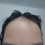 사진ㅇ) 나보다 <b>이마</b>넓은사람?