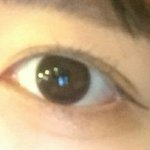 앞트임할까말까