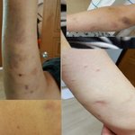 [조언부탁] 반려<b>견이</b> 사람을 물어 죽였을때
