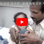 '광견병' - 물에 대해 강한 거부 반응을 보이는 광견병 <b>환자</b>들