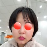 얘들아 코<b>재수술</b>한것좀봐주라
