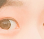 [댓글부탁해] 쌍수 추반좀 !