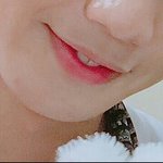 [임영민] <b>앞니</b>수납 실패