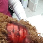 사이코패스한테친구강아지가당했어요