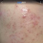 [드루와] 피부 안좋은사람들 진짜 90% 좋아지는법 알려줄게