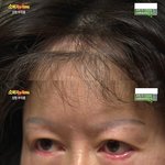 [댓글부탁해] (혐주의) 싸이코패스 <b>의사</b>