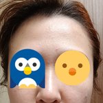 안바르면 땡기고 바르면 여드름이 나요!!