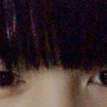 [댓글부탁해] 내 <b>눈밑</b>에 점 이상함?