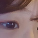쌍수 <b>전이</b> 나음?