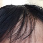 [댓글부탁해] 나처럼 <b>악성</b>직모인 사람 있음?