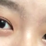 [댓글부탁해] 쌍수 성공