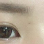 앞트임 라인 부<b>자연스</b>롭?