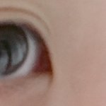 [조언부탁해] 쌍커풀은 짙은데 <b>눈살</b>이 처졌어 쌍수해야될까?