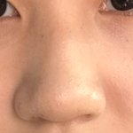 [조언부탁해] ㅅㅂ 복코 어카냐