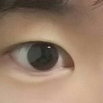 [조언부탁해] 쌍수 해야될까