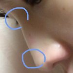 [조언부탁해] 고1들어가기전 코<b>필러</b>맞고싶은데 괜찮을까?