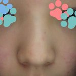 신발 나같은 코는 뭘해야함대체
