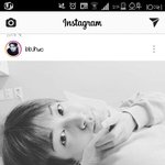 [댓글부탁해] 보톡스 맞는 아이돌