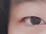 [댓글부탁] 겨울 방학때 쌍수할건데 라인 추천좀