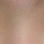 쌍수 짝짝이 <b>재수술</b>해줘?